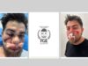 Denuncian presunto influyentismo en investigación de FGE en agresión contra joven rescatista