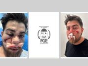 Denuncian presunto influyentismo en investigación de FGE en agresión contra joven rescatista
